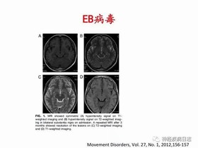 继发性 继发性